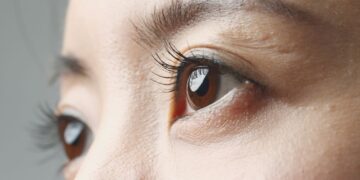 laser eye surgery korea